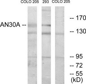 Western blot analysis of extracts from COLO cells and 293 cells, using AN30A antibody.The lane on the right is treated with the synthesized peptide.