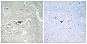 WB was performed on whole cell (25ug, lane 1) and histone extracts (15ug, lane 2 ) from HeLa cells, and on 1ug of recombinant histone H2A, H2B, H3 and H4 (lane 3, 4, 5 and 6, respectively) using the antibody against H2AK5ac. The antibody was diluted 1:1,000 in TBS-Tween containing 5% skimmed milk. The marker (in kDa) is shown on the left