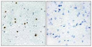 Immunohistochemistry analysis of paraffin-embedded human brain tissue, using DCLK3 antibody.The picture on the right is treated with the synthesized peptide.