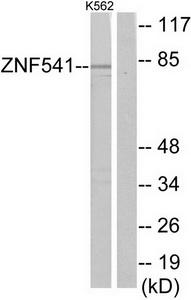 Western blot analysis of extracts from K562 cells, using ZNF541 antibody.The lane on the right is treated with the synthesized peptide.