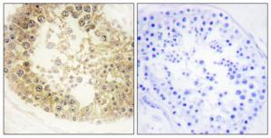 Immunohistochemistry analysis of paraffin-embedded human testis tissue, using ECRG4 antibody.The picture on the right is treated with the synthesized peptide.