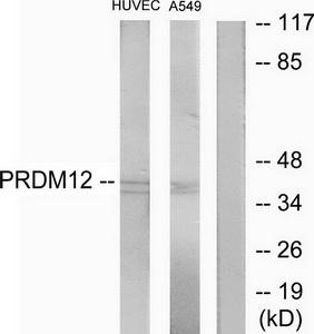 Western blot analysis of extracts from HUVEC cells and A549 cells, using PRDM12 antibody.The lane on the right is treated with the synthesized peptide.