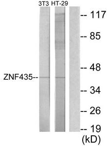 Western blot analysis of extracts from NIH-3T3 cells and HT-29 cells, using ZNF435 antibody.The lane on the right is treated with the synthesized peptide.