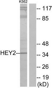 Western blot analysis of extracts from K562 cells, using HEY2 antibody.The lane on the right is treated with the synthesized peptide.