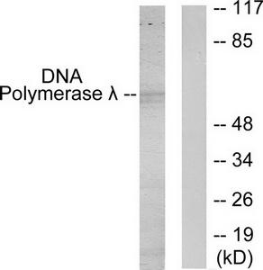 Western blot analysis of extracts from 293 cells, using DNA Polymerase ? antibody.The lane on the right is treated with the synthesized peptide.