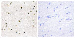 Immunohistochemistry analysis of paraffin-embedded human brain tissue, using AKAP11 antibody.The picture on the right is treated with the synthesized peptide.