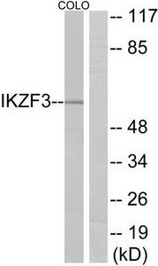 Western blot analysis of extracts from COLO cells, using IKZF3 antibody.The lane on the right is treated with the synthesized peptide.