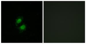 Immunofluorescence analysis of A549 cells, using ZNF95 antibody.The picture on the right is treated with the synthesized peptide.