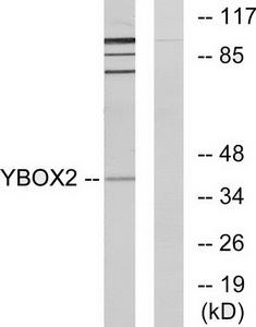 TA348941 (2ug/ml) staining of HeLa (A) and Jurkat (B) lysates (35ug protein in RIPA buffer). Primary incubation was 1 hour. Detected by chemiluminescence.