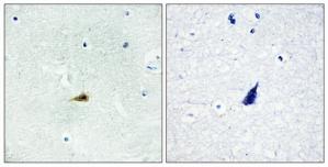 Immunohistochemistry analysis of paraffin-embedded human brain tissue, using NCOR2 antibody.The picture on the right is treated with the synthesized peptide.