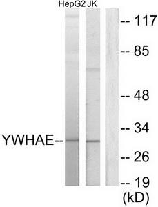 Western blot analysis of extracts from HepG2 cells and Jurkat cells, using 14-3-3 e antibody.The lane on the right is treated with the synthesized peptide.