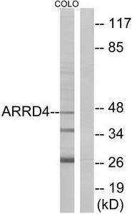 Western blot analysis of extracts from COLO cells, using ARRD4 antibody.The lane on the right is treated with the synthesized peptide.