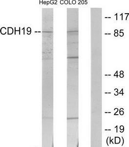 Western blot analysis of extracts from HepG2 cells and COLO205 cells, using CDH19 antibody.The lane on the right is treated with the synthesized peptide.
