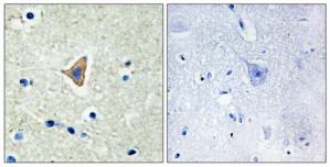 Immunohistochemistry analysis of paraffin-embedded human brain tissue using CDH20 antibody.The picture on the right is treated with the synthesized peptide.