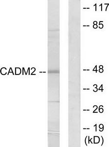 Western blot analysis of extracts from HepG2 cells, using CADM2 antibody.The lane on the right is treated with the synthesized peptide.