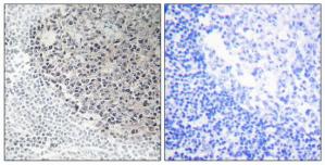 Immunohistochemistry analysis of paraffin-embedded human tonsil tissue using Collagen IX a3 antibody.The picture on the right is treated with the synthesized peptide.