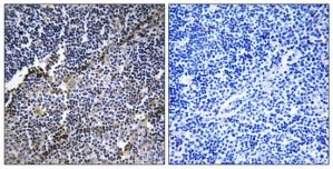 Immunohistochemistry analysis of paraffin-embedded human thymus gland tissue using Collagen XIX a1 antibody.The picture on the right is treated with the synthesized peptide.