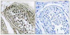 Immunohistochemistry analysis of paraffin-embedded human testis tissue using GAB4 antibody.The picture on the right is treated with the synthesized peptide.