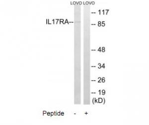 Western blot analysis of extracts from LOVO cells, using IL17RAantibody.The lane on the right is treated with the synthesized peptide.