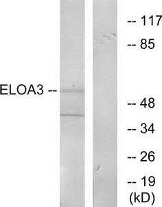 Western blot analysis of extracts from COLO cells, using ELOA3 antibody.The lane on the right is treated with the synthesized peptide.