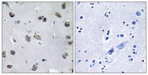 Immunohistochemistry analysis of paraffin-embedded human brain tissue using MIPT3 antibody.The picture on the right is treated with the synthesized peptide.