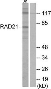 Western blot analysis of extracts from Jurkat cells, using RAD21 antibody.The lane on the right is treated with the synthesized peptide.
