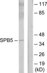 WB using the antibody against H3K36me3 diluted 1:1,000 in TBS-Tween containing 5% skimmed milk. The position of the protein of interest is indicated on the left; the marker (in kDa) is shown on the right.