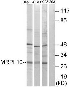 Western blot analysis of extracts from HepG2 cells, COLO cells and 293 cells, using MRPL10 antibody.The lane on the right is treated with the synthesized peptide.