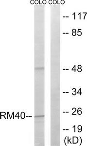 Western blot analysis of extracts from COLO cells, using MRPL40 antibody.The lane on the right is treated with the synthesized peptide.