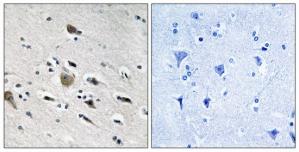Immunohistochemistry analysis of paraffin-embedded human brain tissue using MRPL52 antibody.The picture on the right is treated with the synthesized peptide.