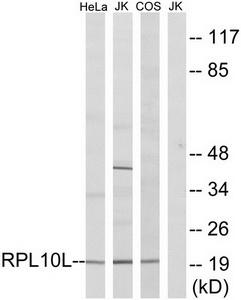 Western blot analysis of extracts from HeLa cells, Jurkat cells and COS7 cells, using RPL10L antibody.The lane on the right is treated with the synthesized peptide.