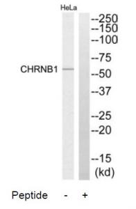 Western blot analysis of extracts from HeLa cells, using CHRNB1 antibody.The lane on the right is treated with the synthesized peptide.