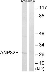 Western blot analysis of extracts from rat brain cells, using ANP32B antibody.The lane on the right is treated with the synthesized peptide.