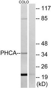 Western blot analysis of extracts from COLO cells, using PHCA antibody.The lane on the right is treated with the synthesized peptide.