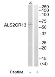 Western blot analysis of extracts from Jurkat cells, using ALS2CR13 antibody.The lane on the right is treated with the synthesized peptide.