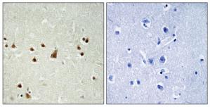 Immunohistochemistry analysis of paraffin-embedded human brain tissue using ANKRD26 antibody.The picture on the right is treated with the synthesized peptide.