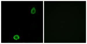 Immunofluorescence analysis of A549 cells, using ABCA13 antibody.The picture on the right is treated with the synthesized peptide.