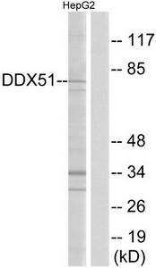 Western blot analysis of extracts from HepG2 cells, using DDX51 antibody.The lane on the right is treated with the synthesized peptide.