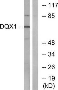 Western blot analysis of extracts from COS-7 cells, using DQX1 antibody.The lane on the right is treated with the synthesized peptide.