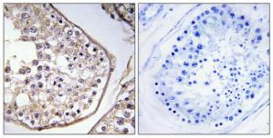 Immunohistochemistry analysis of paraffin-embedded human testis tissue using BAGE3 antibody.The picture on the right is treated with the synthesized peptide.