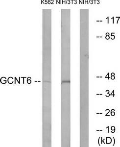 Western blot analysis of extracts from K562 cells and NIH/3T3 cells, using GCNT6 antibody.The lane on the right is treated with the synthesized peptide.