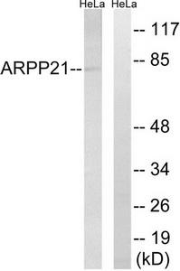 Western blot analysis of extracts from HeLa cells, using ARPP21 antibody.The lane on the right is treated with the synthesized peptide.