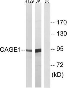 Western blot analysis of extracts from HT-29 cells and Jurkat cells, using CAGE1 antibody.The lane on the right is treated with the synthesized peptide.