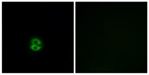 Immunofluorescence analysis of A549 cells, using CHST6 antibody.The picture on the right is treated with the synthesized peptide.