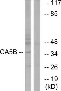 Western blot analysis of extracts from NIH/3T3 cells, using CA5B antibody.The lane on the right is treated with the synthesized peptide.