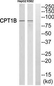 Western blot analysis of extracts from HepG2 cells and K562 cells, using CPT1B antibody.The lane on the right is treated with the synthesized peptide.