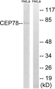 Western blot analysis of extracts from HeLa cells, using CEP78 antibody.The lane on the right is treated with the synthesized peptide.