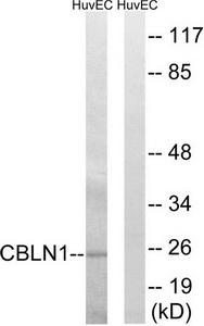 Western blot analysis of extracts from HUVEC cells, using CBLN1 antibody.The lane on the right is treated with the synthesized peptide.