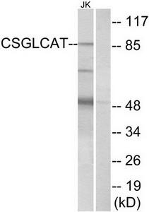 Western blot analysis of extracts from Jurkat cells, using CSGLCAT antibody.The lane on the right is treated with the synthesized peptide.
