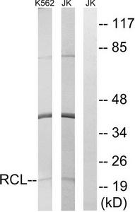 Western blot analysis of extracts from K562 cells and Jurkat cells, using RCL antibody.The lane on the right is treated with the synthesized peptide.